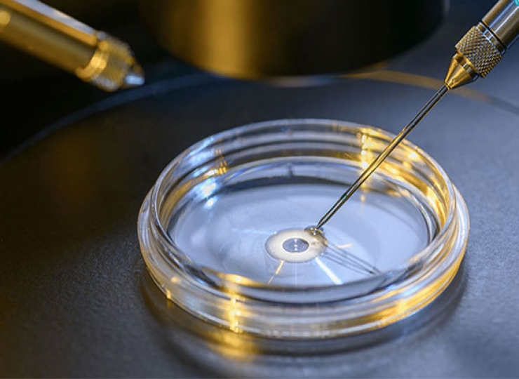 ivf ????