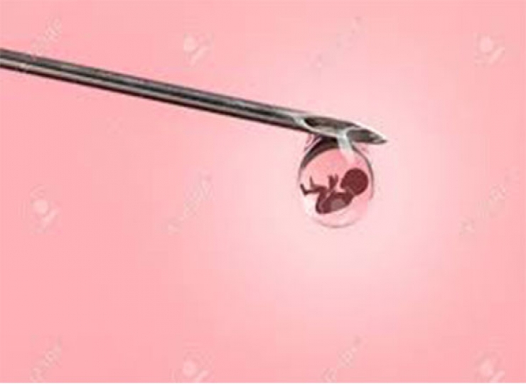 ????? ??? IVF